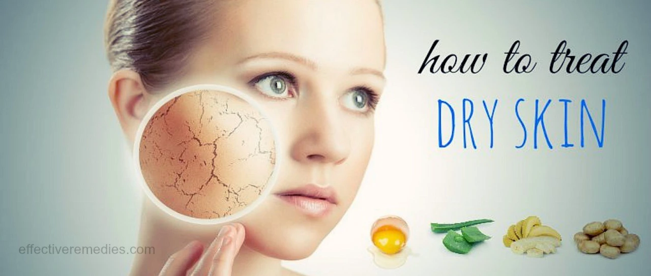 Hydrocortisone for Dry Skin: A Moisturizing Treatment to Consider